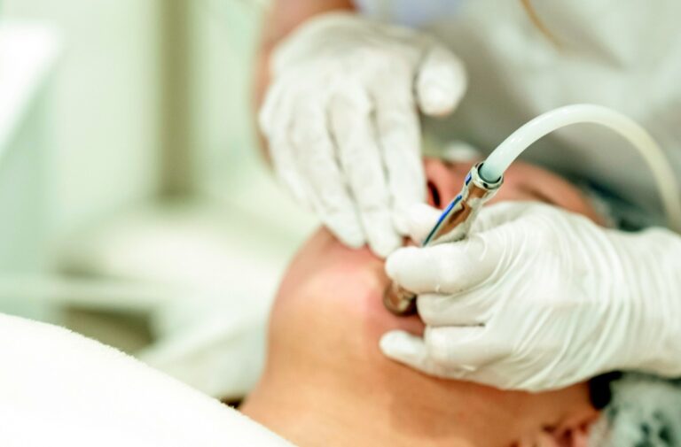 Laser tulowy MOXI czy mikrodermabrazja